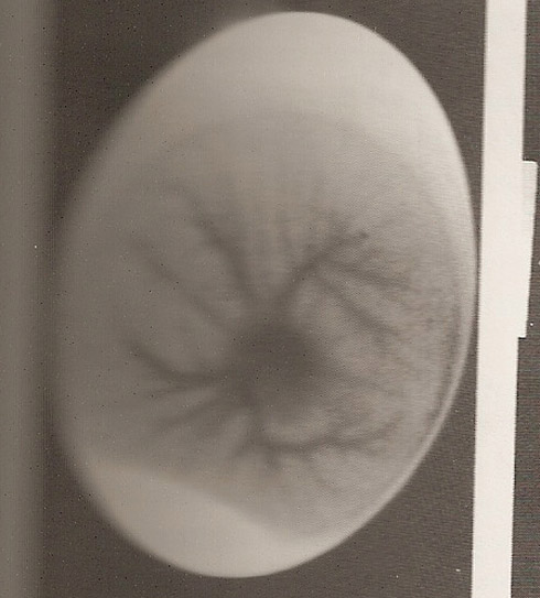 Incubated egg Incubated egg